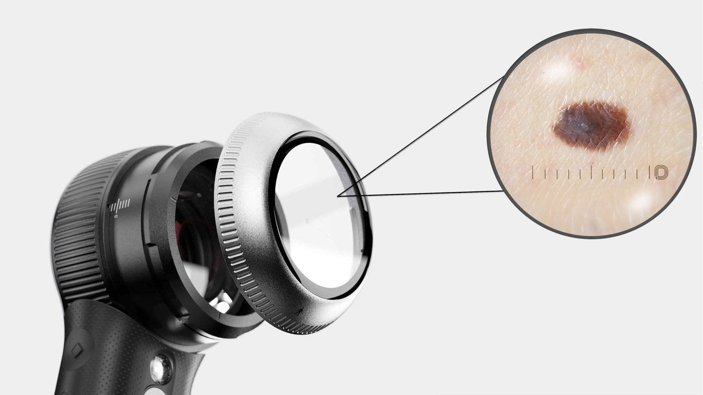 Replacement contact plate (aka, "faceplate") for the Dermlite DL5 w/ 10mm reticle