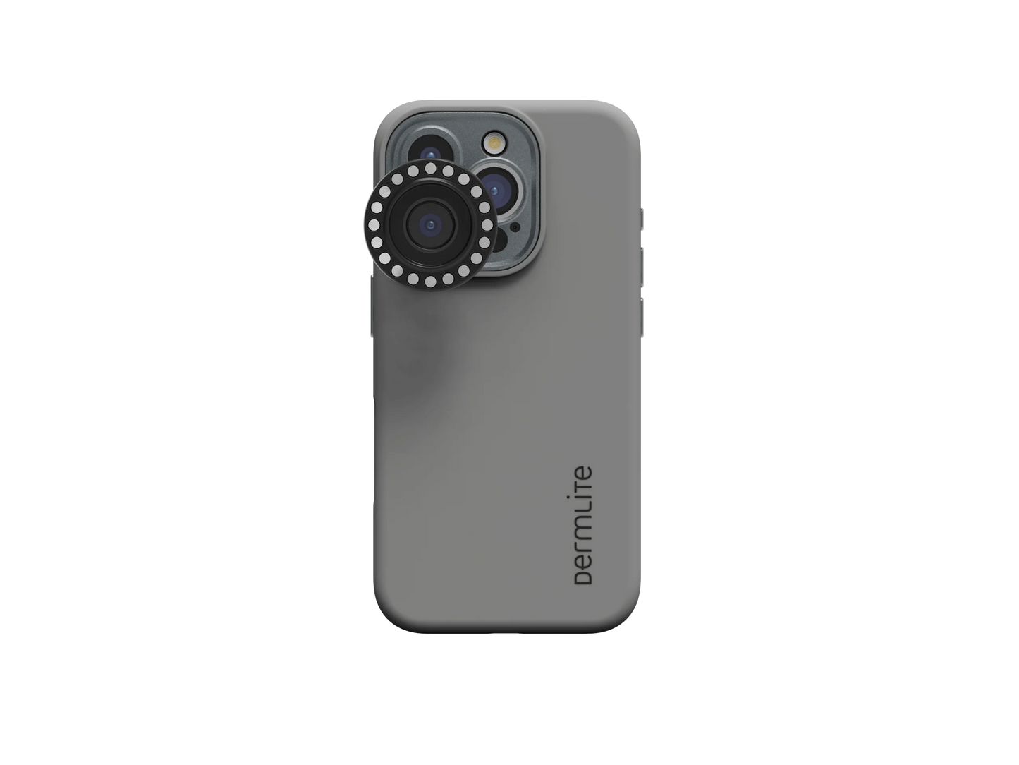 Introducing the DermLite DL Connection Kit for iPhone 16 Series—a must-have accessory featuring a sleek gray case with a circular ring light attached to the rear camera. Perfectly designed for MagnetiConnect-compatible dermatoscopes, this smart connection kit prominently displays the DermLite brand name. Pre-order now and experience seamless integration with your iPhone 16 cases.