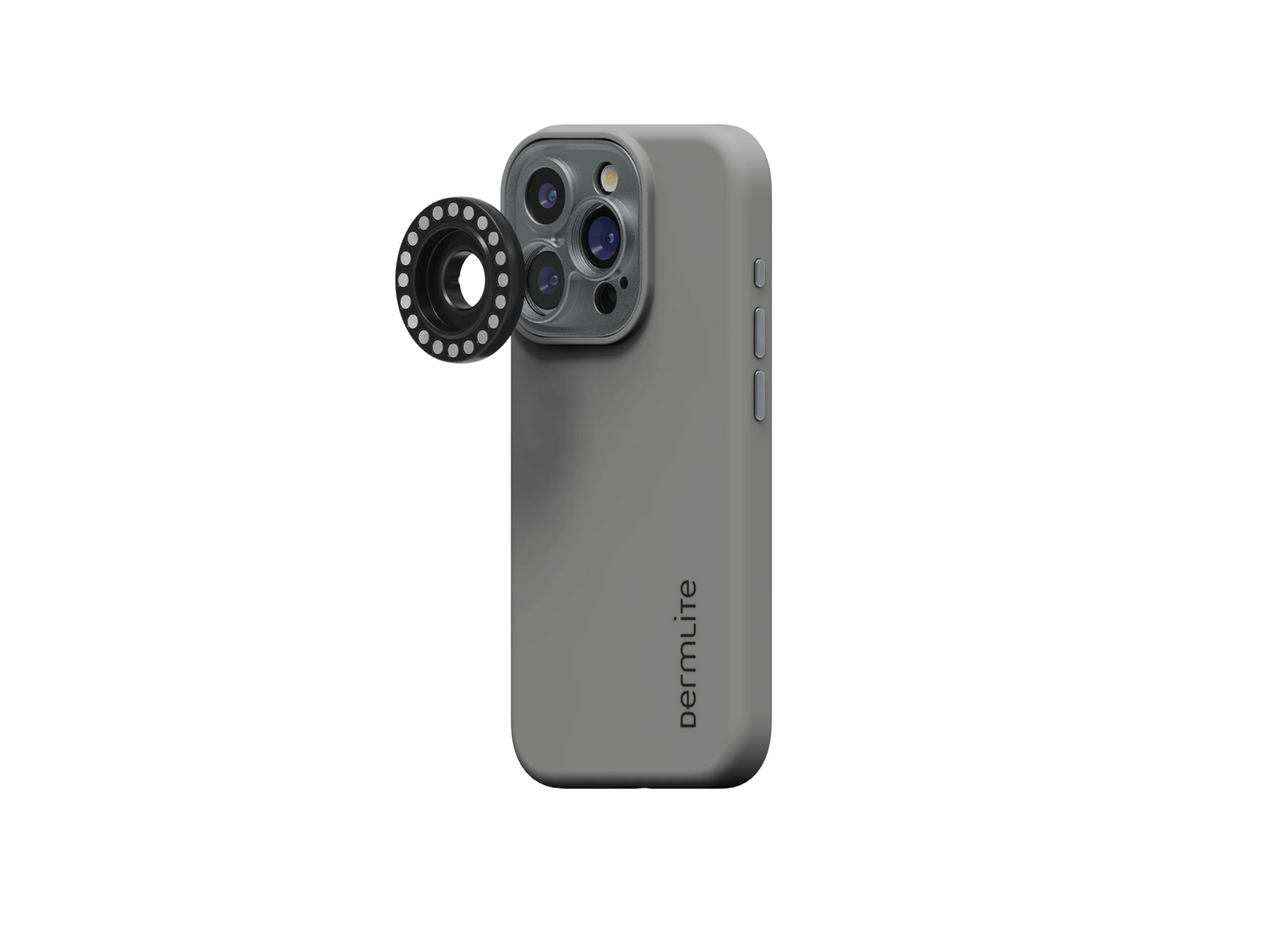 Introducing the revolutionary DL Connection Kit for iPhone 16 Series by DermLite, featuring multiple rear cameras with an innovative ring-shaped lens attachment. Now available for pre-order, this kit is fully MagnetiConnect-compatible, ensuring seamless integration with dermatoscopes and iPhone 16 cases.
