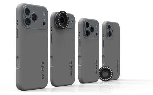 DL Connection Kit for iPhone 17 Series - Dermatoscopes.com