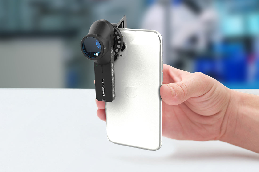 DermLite DL1 basic - Dermatoscopes.com