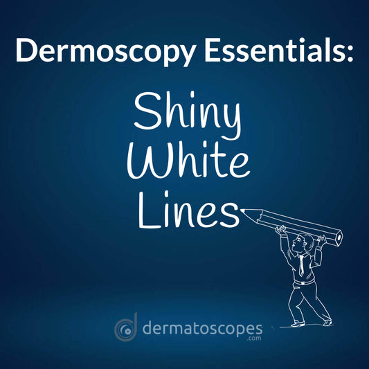 Dermoscopy Essentials: Shiny White Lines