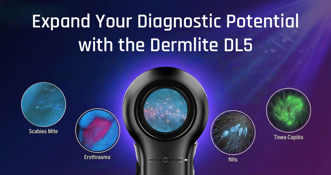 Expand Your Diagnostic Potential with the Dermlite DL5
