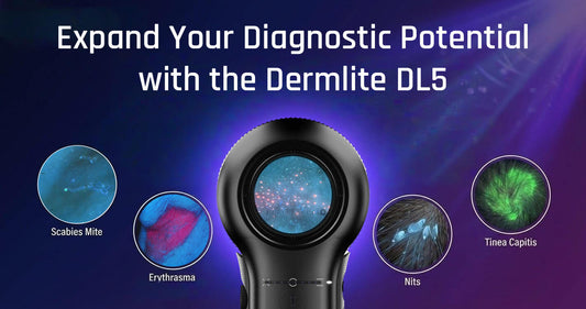Expand Your Diagnostic Potential with the Dermlite DL5
