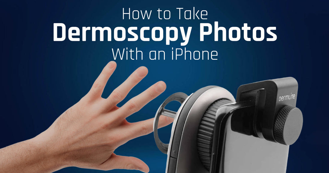 iPhone taking dermoscopy photos with Dermlite dermatoscope