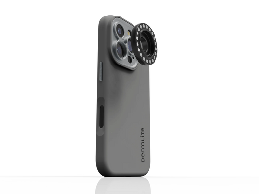 A smartphone with a DermLite DL Connection Kit for iPhone 16 Series and a MagnetiConnect-compatible dermatoscope attached to the camera, placed in a grey case. Pre-order now.