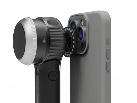 A close-up of a smartphone with an attached camera accessory, featuring a cylindrical lens and a grey phone case. Pre-order the DermLite DL Connection Kit for iPhone 16 Series now, and ensure your device is ready for MagnetiConnect-compatible dermatoscopes.