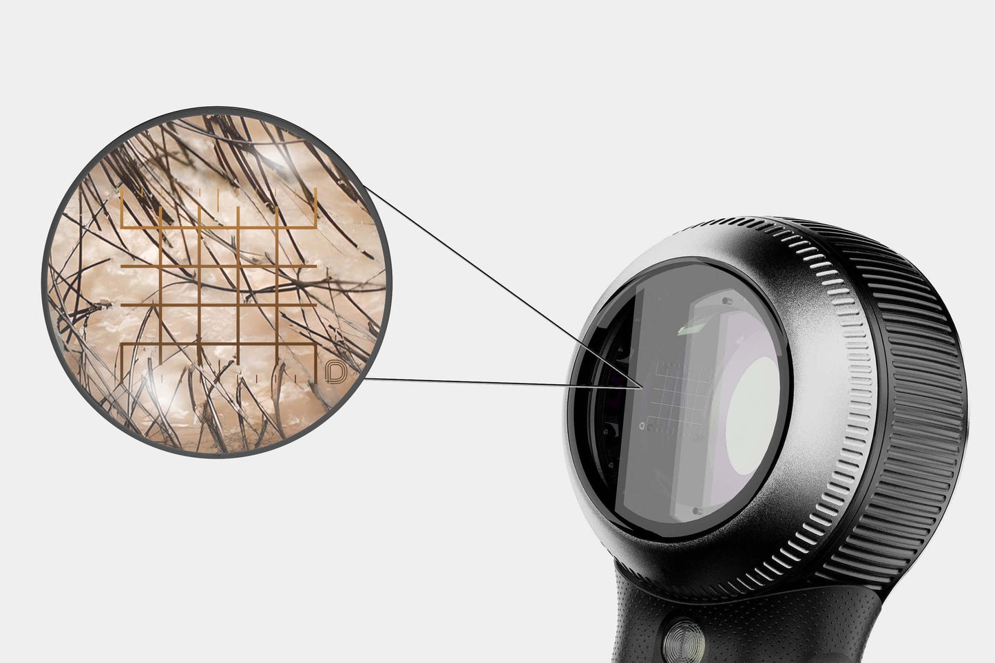 A close-up view of a DermLite DL5 Contact Plate (w/ Grid Reticle) with a magnified inset showing trapped hairs and debris on a 10x10mm grid.