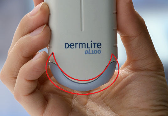 Battery Cap - Dermlite DL100 - Dermatoscopes.com